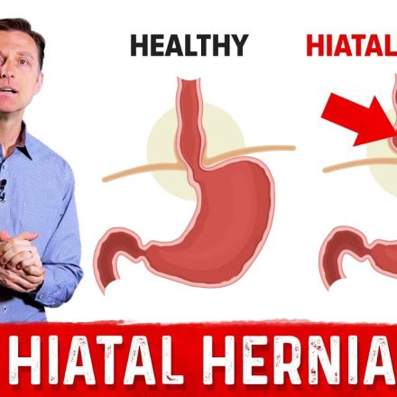 HIATAL HERNIA: HOW DOES IT AFFECT YOUR STOMACH?