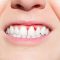 Things you should know about gum disease treatment and recovery